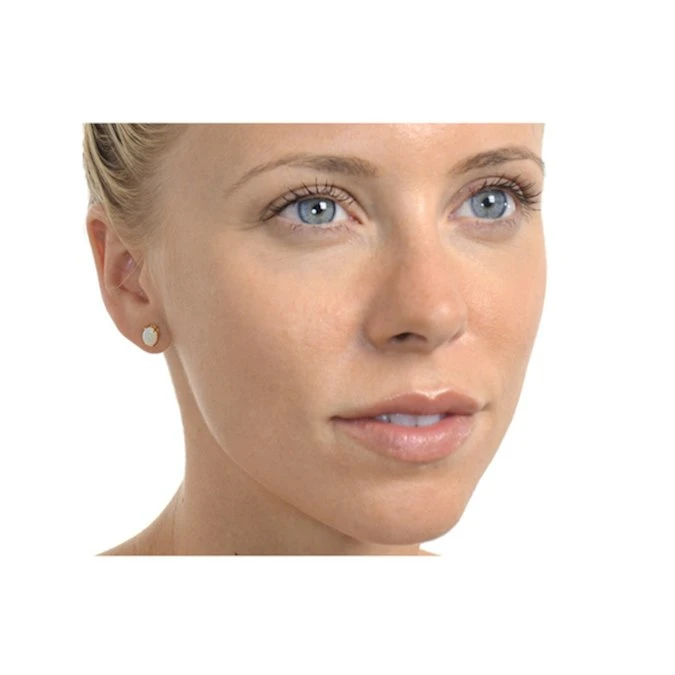 Opal 7 X 5mm 9K Yellow Gold Earrings 2 Opal 7 X 5mm 9K Yellow Gold Earrings - Image 2